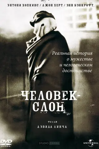Человек-слон